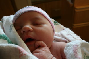 【怀孕妊娠合并新生儿粘脂贮积症II型怎么对症支持】